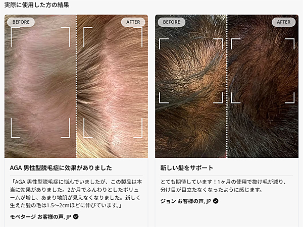cカレントボディ スキンLED 頭皮ケア